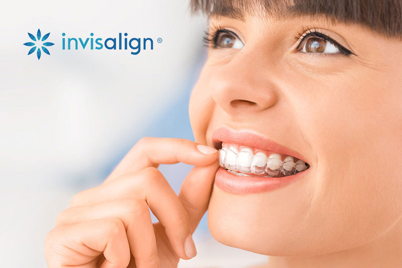 Teeth Whitening in Pea Ridge